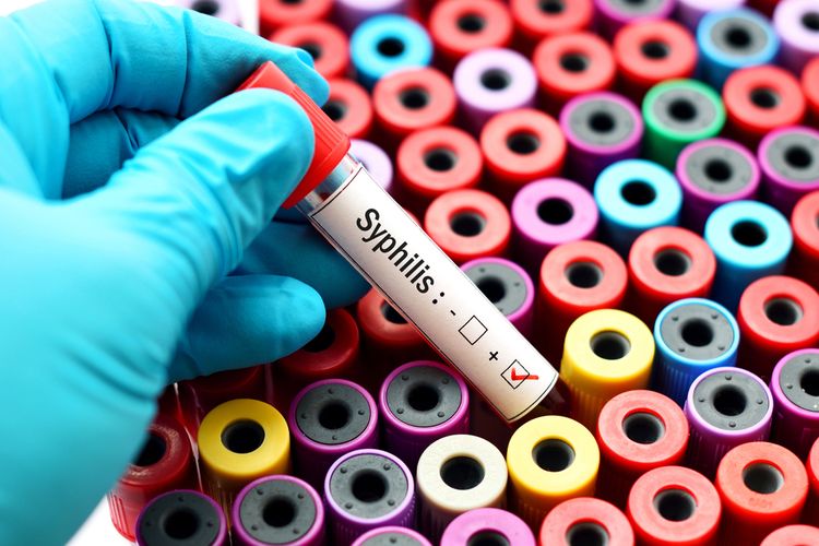 Kasus Sifilis di Indonesia Meningkat