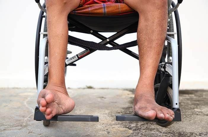Penyakit Polio Terdeteksi Di AS
