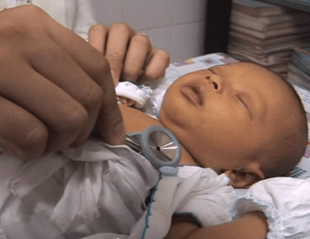 Hepatitis Misterius Menyerang Anak-anak