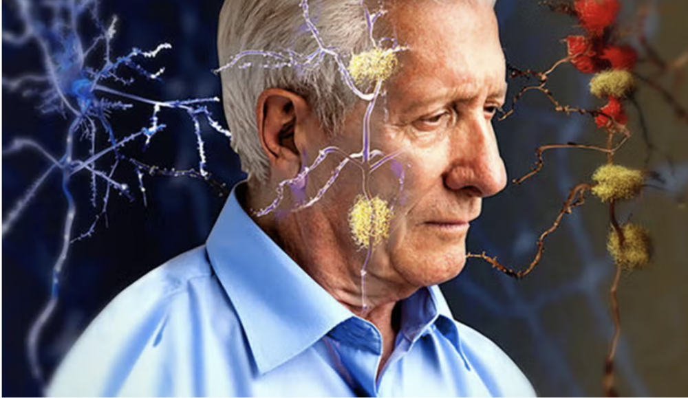 Tertipu Keuangan Tanda Terkena Penyakit Alzheimer